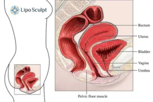 Treatment For A Leaky Bladder 2 How EM Chair treatment Wibsey can help Leaky bladder issues. Read more now!